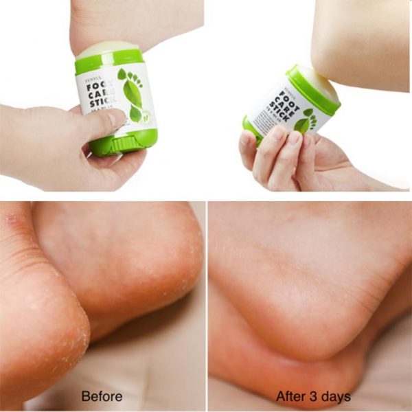 EUNYUL Foot Care Stick 20g - Image 2