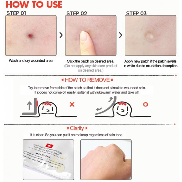 COSRX Acne Pimple Master (24 patches) - Image 3